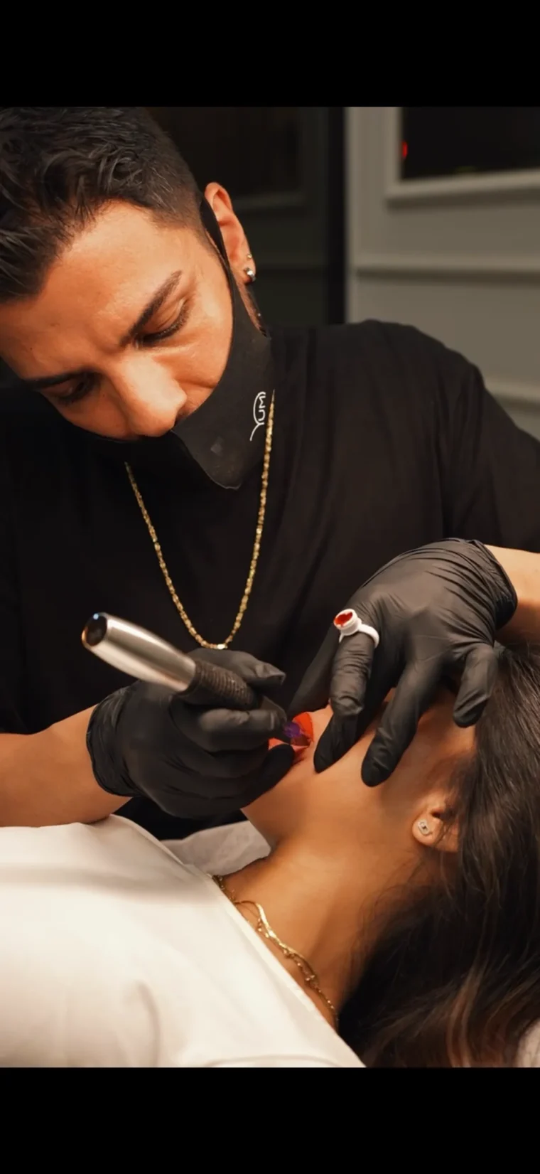 dudak gençleştirme la coulisse